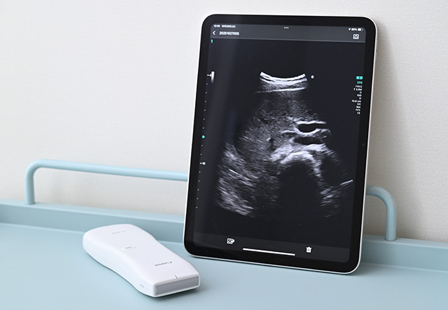 超音波診断装置 Aplio air